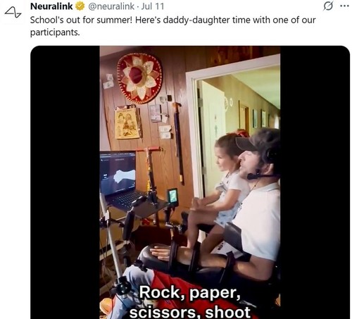 뉴럴링크가 지난 7월 11일 엑스에 게시한 BCI 칩 임상시험 참가자 영상/@Neuralink X 게시물 캡처